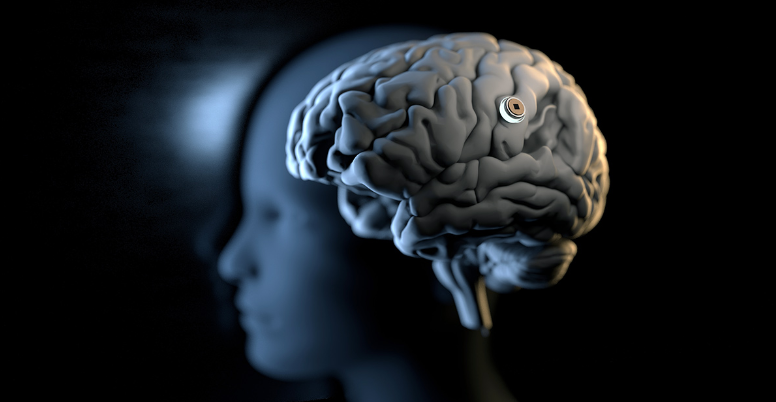 马斯克：Neuralink今年将进行脑机接口植入人体的首例试验-多多发布网(图1)